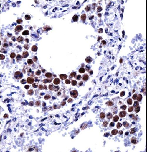 ARIH2 Antibody immunohistochemistry of formalin-fixed and paraffin-embedded human lung tissue followed by peroxidase-conjugated secondary antibody and DAB staining.