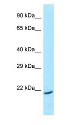ARL1 antibody Western Blot of HepG2.