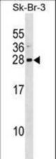 ARL1 Antibody western blot of SK-BR-3 cell line lysates (35 ug/lane). The ARL1 antibody detected the ARL1 protein (arrow).
