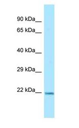 ARL1 antibody Western Blot of MCF7.