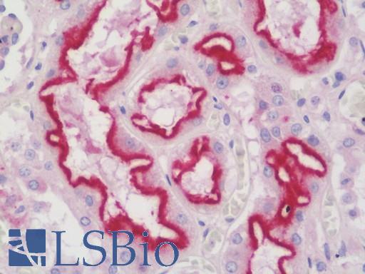 Anti-ARL10 antibody IHC staining of human kidney. Immunohistochemistry of formalin-fixed, paraffin-embedded tissue after heat-induced antigen retrieval. Antibody LS-B10369 dilution 1:100.