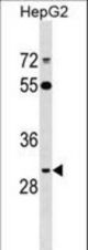 ARL10 Antibody western blot of HepG2 cell line lysates (35 ug/lane). The ARL10 antibody detected the ARL10 protein (arrow).