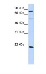 293T cell lysate. Antibody concentration: 1.0 ug/ml. Gel concentration: 12%.