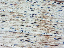 IHC of paraffin-embedded Human colon tissue using anti-ARL11 mouse monoclonal antibody.