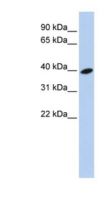 ARL13B antibody LS-C102470 Western blot of 721_B cell lysate.