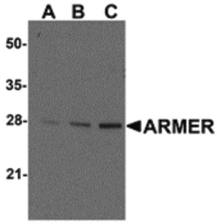 Western blot ana-lysis of ARMER in mouse small intestine tissue lysates with ARMER antibody at (A) 0.5, (B) 1, and (C) 2 ug/ml.