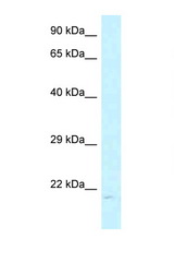 ARL6IP1 / ARMER antibody LS-C145564 Western blot of MCF7 Cell lysate. Antibody concentration 1 ug/ml.