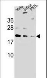ARL6IP6Antibody western blot of A375,HeLa,Jurkat cell line lysates (35 ug/lane). The ARL6IP6 antibody detected the ARL6IP6 protein (arrow).