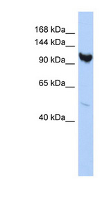 ARMC3 antibody LS-C102679 Western blot of HepG2 cell lysate.