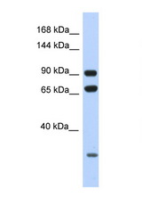 ARMC4 antibody LS-C146107 Western blot of HeLa Cell lysate. Antibody concentration 1 ug/ml.