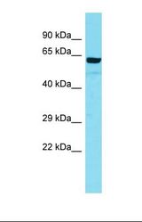 Western blot of Human THP-1. ARMC5 antibody dilution 1.0 ug/ml.