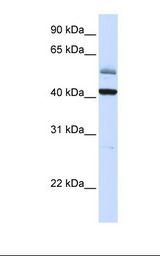 Placenta lysate. Antibody concentration: 1.0 ug/ml. Gel concentration: 12%.