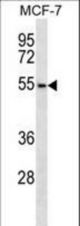 ARMCX1 Antibody western blot of MCF-7 cell line lysates (35 ug/lane). The ARMCX1 antibody detected the ARMCX1 protein (arrow).