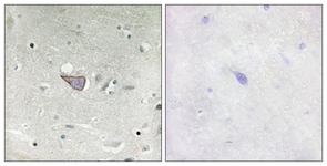 IHC of paraffin-embedded human brain tissue, using ARMX3 Antibody. The picture on the right is treated with the synthesized peptide.