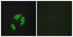 Immunofluorescence of HepG2 cells, using ARMX3 Antibody. The picture on the right is treated with the synthesized peptide.