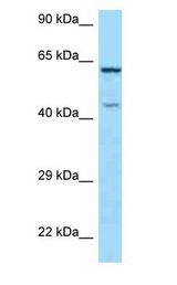 ARMCX5 antibody Western Blot of HeLa.