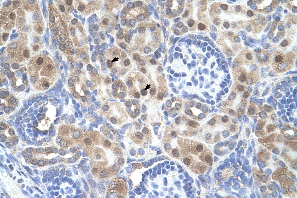 ARMCX6 antibody LS-C40487 IHC of formalin-fixed, paraffin-embedded human Kidney. Positive label: Epithelial cells of renal tubule indicated with arrows. Antibody concentration 4-8 ug/ml. Magnification 400X.