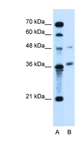 ARMCX6 antibody LS-C40487 Western blot of Jurkat lysate.