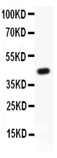 HIF1 beta antibody Western blot. All lanes: Anti HIF1 beta at 0.5 ug/ml. WB: Recombinant Human HIF1 beta Protein 0.5ng. Predicted band size: 49 kD. Observed band size: 49 kD.