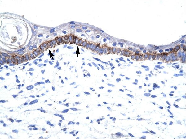 ARNTL / BMAL1 antibody LS-C30625 was used in IHC to stain formalin-fixed, paraffin-embedded human skin.