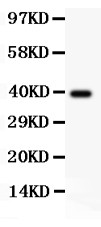 AAMP antibody Western blot. All lanes: Anti AAMP at 0.5 ug/ml. WB: Recombinant Human AAMP Protein 0.5ng. Predicted band size: 39 kD. Observed band size: 39 kD.