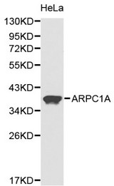 Western blot of ARPC1A pAb in extracts from Hela cells.