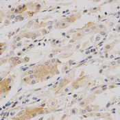 Immunohistochemistry of paraffin-embedded human stomach using ARPC1A antibody at dilution of 1:200 (x400 lens)