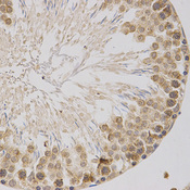 Immunohistochemistry of paraffin-embedded rat testis using ARPC1A antibody at dilution of 1:200 (x400 lens).