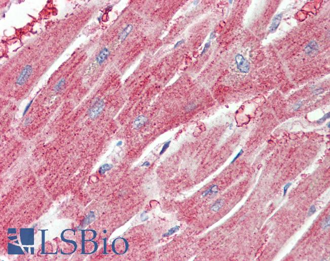Anti-ARPC1A antibody IHC staining of human heart. Immunohistochemistry of formalin-fixed, paraffin-embedded tissue after heat-induced antigen retrieval. Antibody LS-B9553 concentration 5 ug/ml.