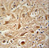 ARPC1A Antibody immunohistochemistry of formalin-fixed and paraffin-embedded human brain tissue followed by peroxidase-conjugated secondary antibody and DAB staining.
