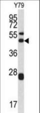 Western blot of ARPC1A antibody in Y79 cell line lysates (35 ug/lane). ARPC1A (arrow) was detected using the purified antibody.