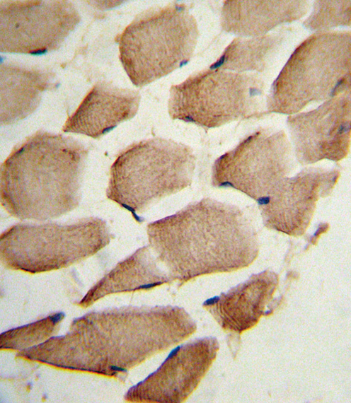 Formalin-fixed and paraffin-embedded human skeletal muscle reacted with ARPC1A Antibody , which was peroxidase-conjugated to the secondary antibody, followed by DAB staining. This data demonstrates the use of this antibody for immunohistochemistry; clinical relevance has not been evaluated.