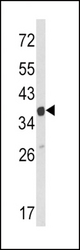 Western blot of ARPC1A Antibody in HeLa cell line lysates (35 ug/lane). ARPC1A (arrow) was detected using the purified antibody.