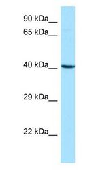 ARPC1B / p41-ARC / ARP2 antibody Western Blot of Fetal Lung.