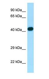 ARPC1B / p41-ARC / ARP2 antibody Western Blot of Fetal Lung.