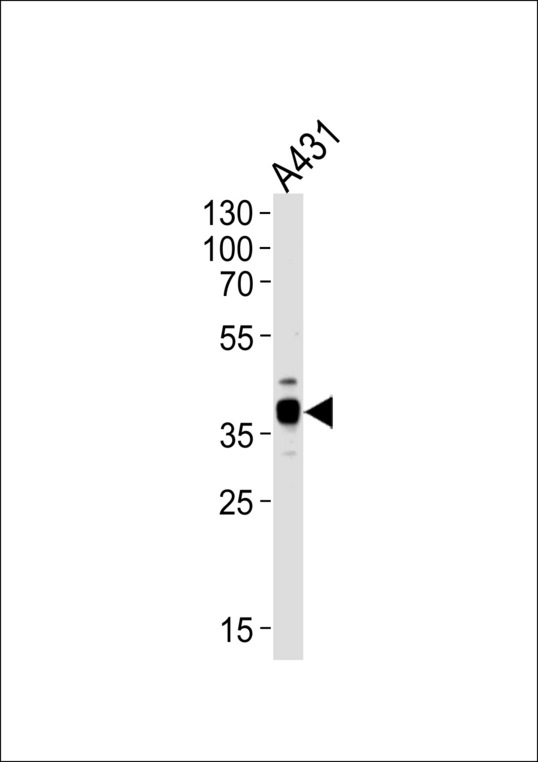 Western blot of lysate from A431 cell line, using ARPC1B Antibody. Antibody was diluted at 1:1000 at each lane. A goat anti-rabbit IgG H&L (HRP) at 1:5000 dilution was used as the secondary antibody. Lysate at 35ug per lane.