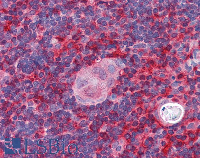 Anti-ARPC1B / p41-ARC antibody IHC of human thymus. Immunohistochemistry of formalin-fixed, paraffin-embedded tissue after heat-induced antigen retrieval. Antibody LS-B2744 concentration 5 ug/ml.