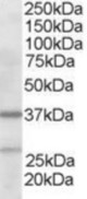 Antibody staining (2 ug/ml) of Human Liver lysate (RIPA buffer, 35 ug total protein per lane). Primary incubated for 1 hour. Detected by Western blot of chemiluminescence.