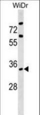 ARPC2 Antibody western blot of WiDr cell line lysates (35 ug/lane). The ARPC2 antibody detected the ARPC2 protein (arrow).