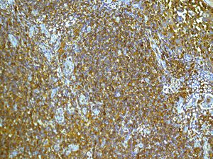 IHC of paraffin-embedded human tonsil tissue using anti-ARPC2 antibody.