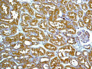 IHC of paraffin-embedded human kidney tissue using anti-ARPC2 antibody.
