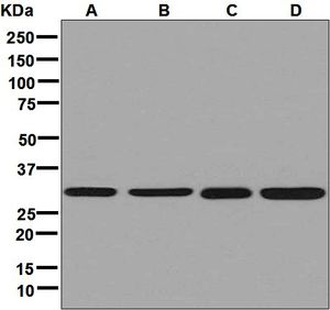 Western blot analysis on (A) HeLa, (B) 293T, (C) HT-1080, and (D) Jurkat cell lysates using anti-ARPC2 antibody.