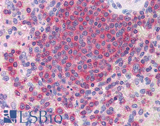 Anti-ARPC2 antibody IHC of human spleen. Immunohistochemistry of formalin-fixed, paraffin-embedded tissue after heat-induced antigen retrieval. Antibody LS-B2742 concentration 75 ug/ml.