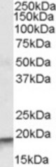 Antibody (0.03 ug/ml) staining of Human Lymph Node lysate (35 ug protein in RIPA buffer). Primary incubation was 1 hour. Detected by chemiluminescence