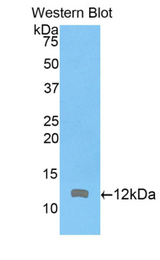 Western blot of recombinant ARPC4.