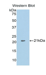 Western blot of recombinant ARPC4.