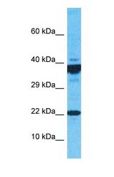Western blot of ARPC4 Antibody with human MCF7 Whole Cell lysate.