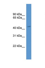 ARR3 / Arrestin C antibody LS-C135605 Western blot of Fetal Brain lysate. Antibody concentration 1 ug/ml.