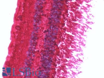 Anti-ARR3 / Cone Arrestin antibody IHC staining of human retina. Immunohistochemistry of formalin-fixed, paraffin-embedded tissue after heat-induced antigen retrieval.