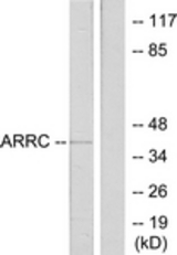 Western blot of extracts from LOVO cells, using ARRC Antibody. The lane on the right is treated with the synthesized peptide.